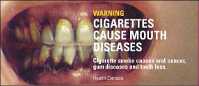 Canadian cigarette warning label: \"Cigarettes cause mouth diseases\"