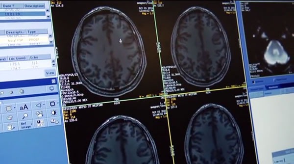 fmri scans fmri scans