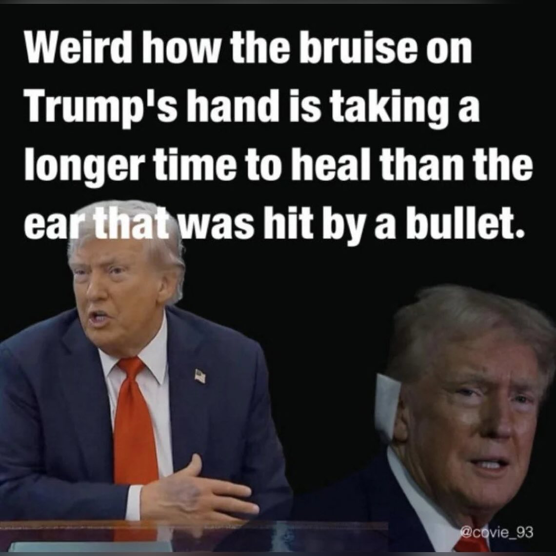 bruise-on-trumps-hand