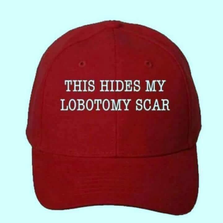 this-hides-my-lobotomy-scar