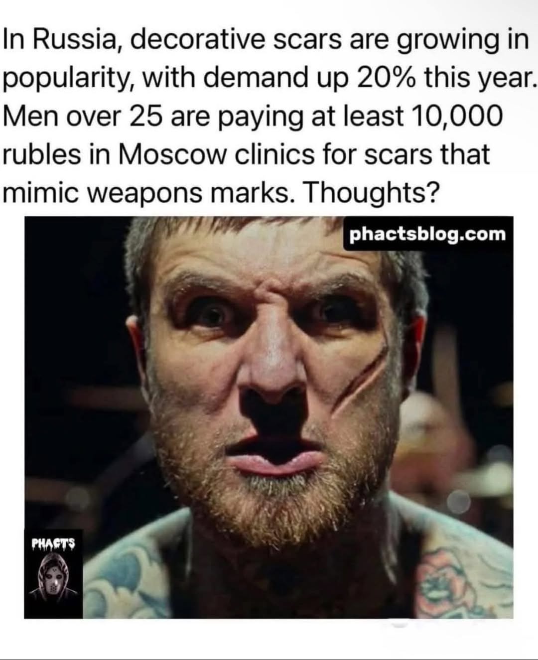 decorative-scars-in-russia